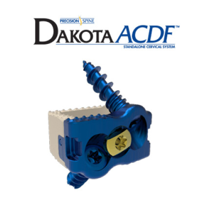 Dakota ACDF™ System