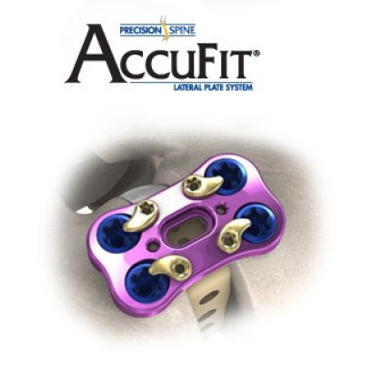 AccuFit® Lateral Plate System