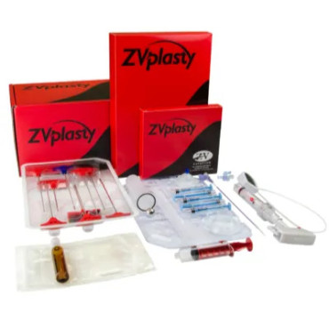 ZVplasty